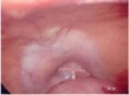 /album/photogallery/laparoscopy1a-1-jpg/